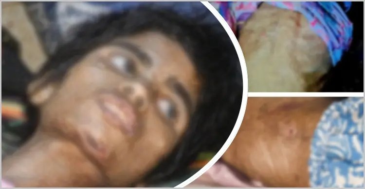 বাথরুমে বন্দি রাখা হতো শিশু তানিয়াকে, নির্যাতনে শরীরে পচন