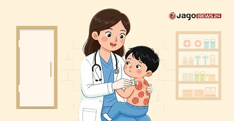 হাম উপসর্গে আরও দুই শিশুর মৃত্যু