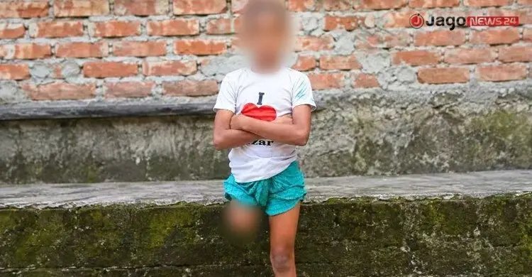 অবুঝ রায়হানের পা কেটে বানানো হয় ‘ভিক্ষার মেশিন’