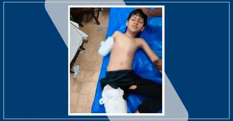 পর্যটক এক্সপ্রেসের ধাক্কায় হাত-পা হারানো সেই শিশুটি মারা গেছে