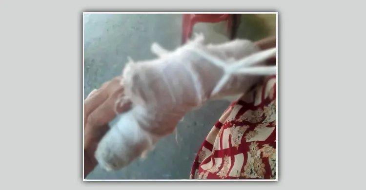 ভাবিকে শ্লীলতাহানির পর হাতের আঙুল ভেঙে দিলেন দেবর